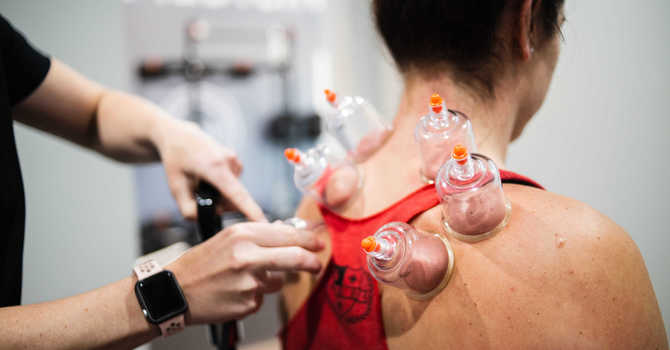 Reduce Inflammation & Improve Blood Flow with Cupping Therapy image